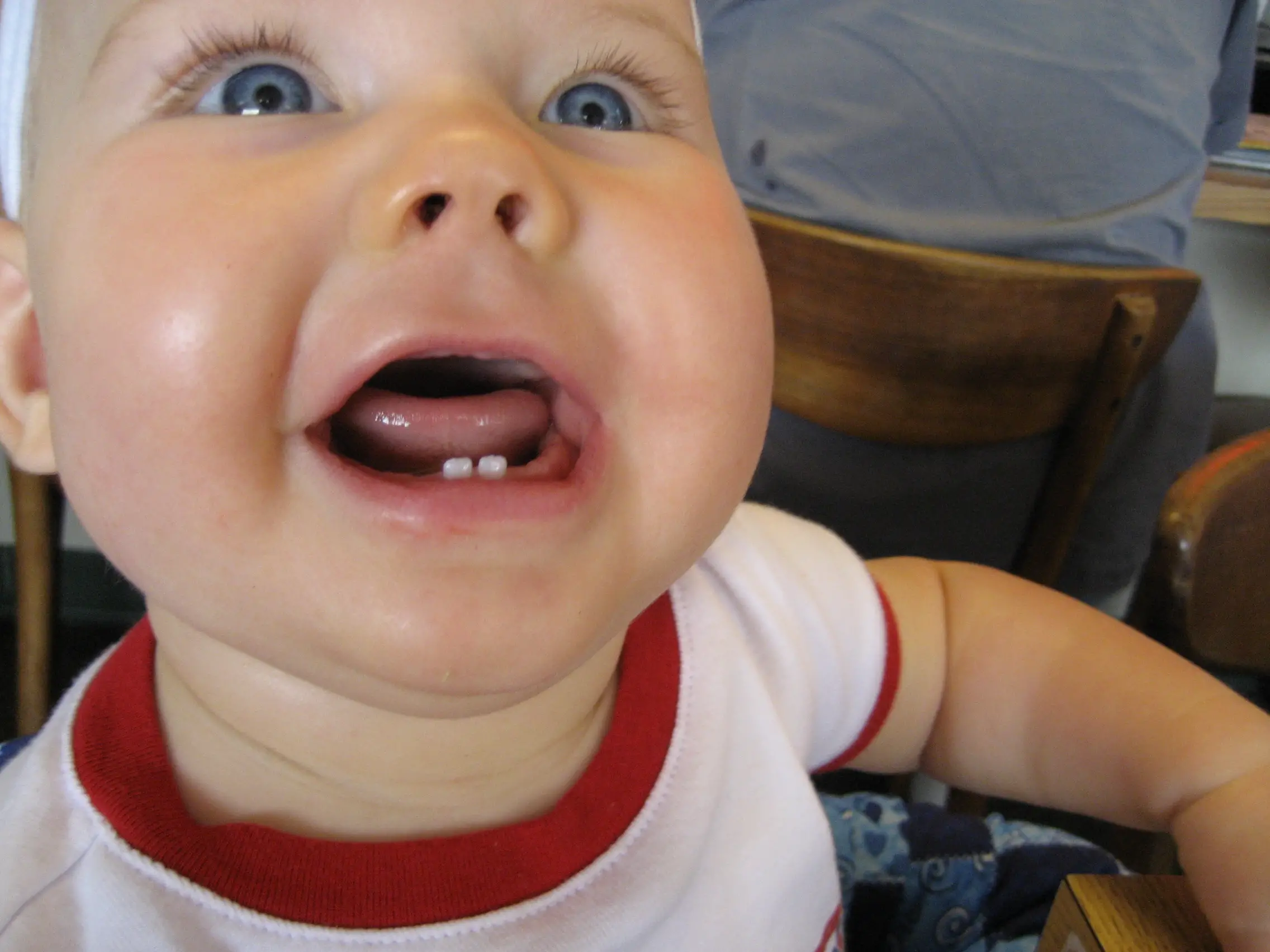 первый зуб фото прорезывания