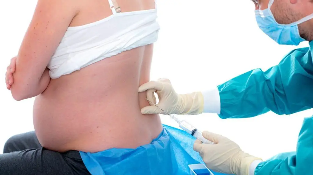Ventajas y desventajas de utilizar anestesia epidural para calmar el dolor de parto