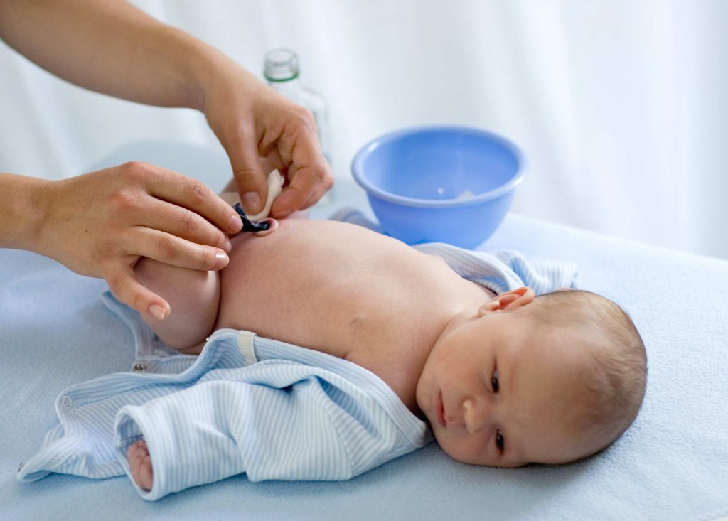 Cómo cuidar el cordón umbilical del recién nacido