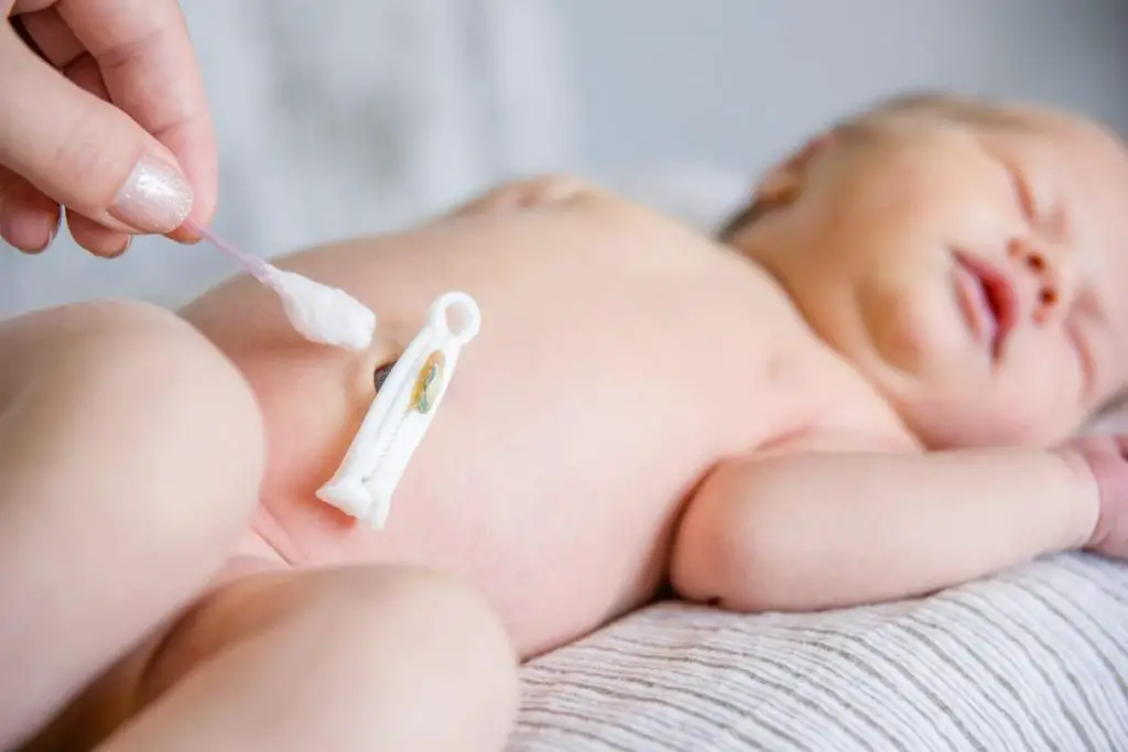 Cómo cuidar el cordón umbilical del recién nacido