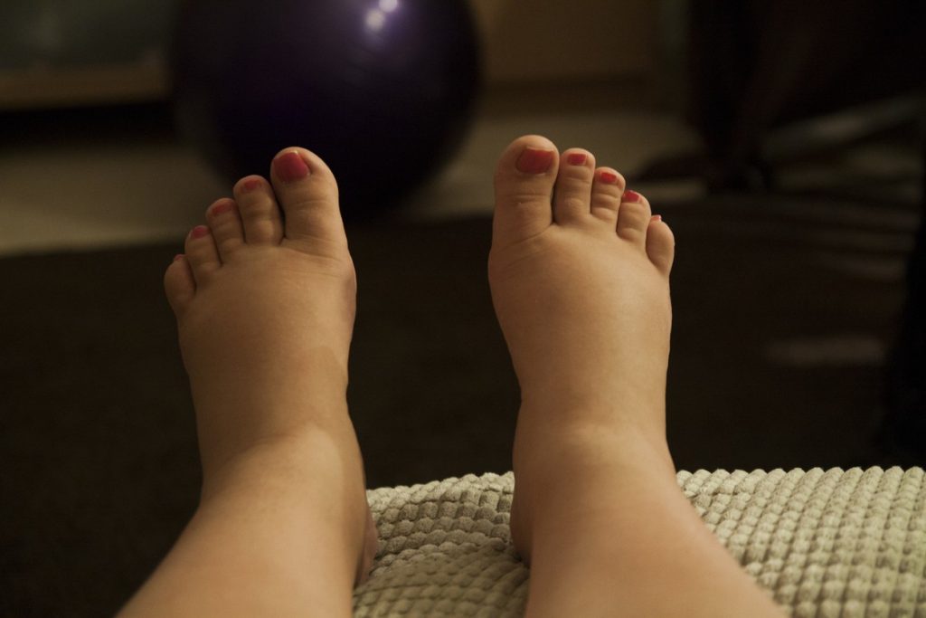 Por qué se hinchan los pies en el embarazo