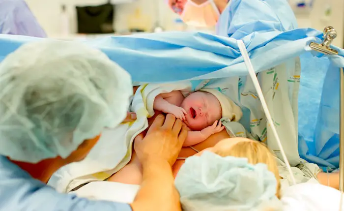 bebe en una cesarea