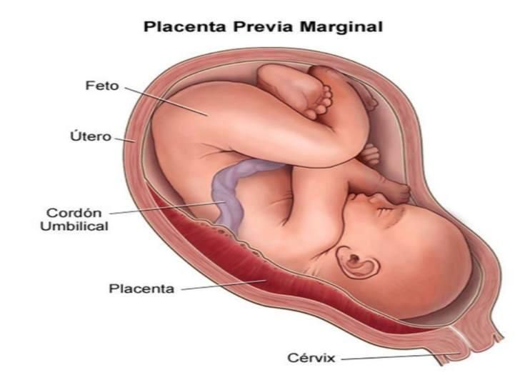 que es la placenta