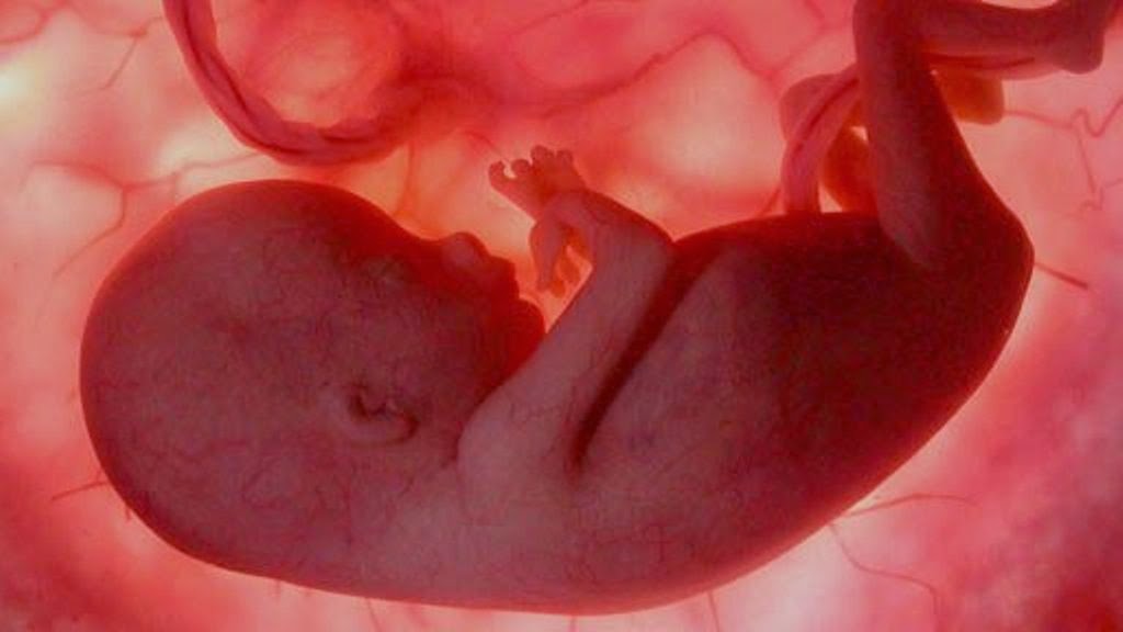 imágenes del embarazo feto de 18 semanas