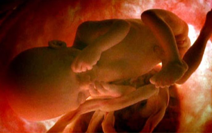 imágenes del embarazo feto de 22 semanas