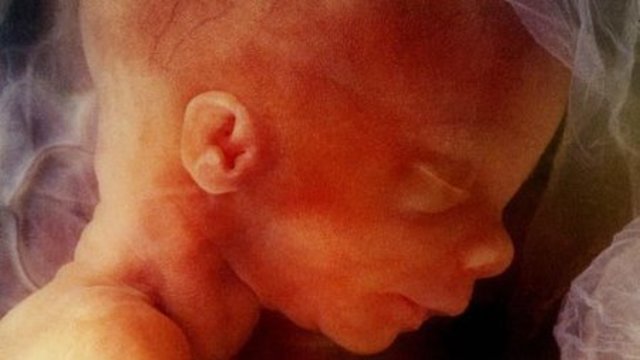 imágenes del embarazo feto de 24 semanas
