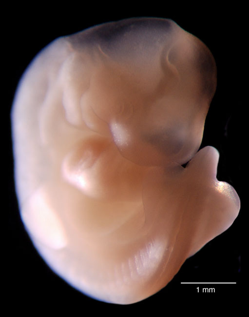 imágenes del embarazo feto de cinco semanas