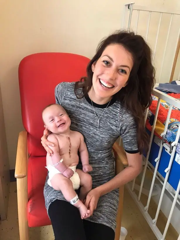 sonrisa de bebe despues de operacion