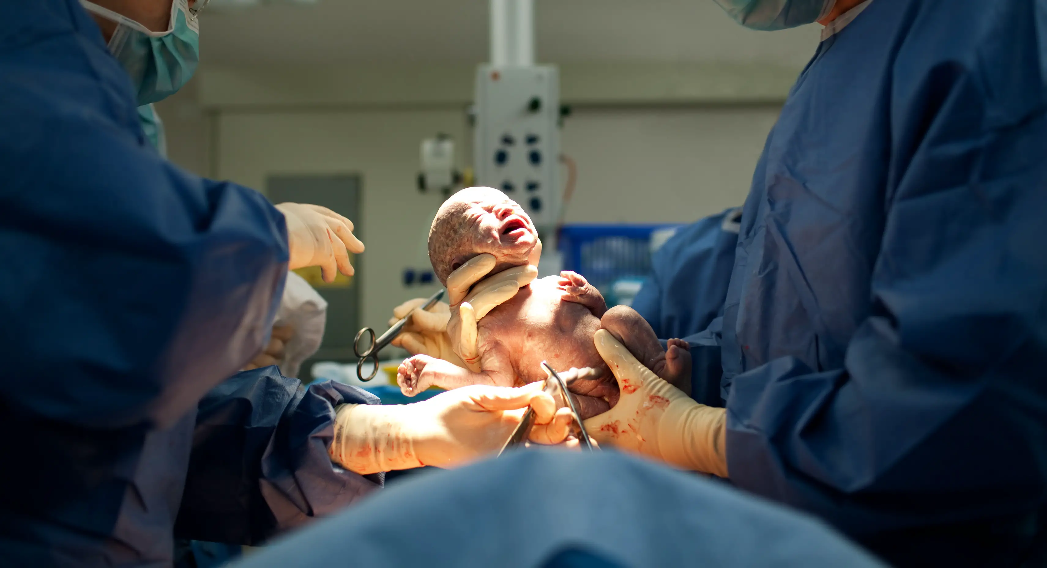 Adaptacion neonatal