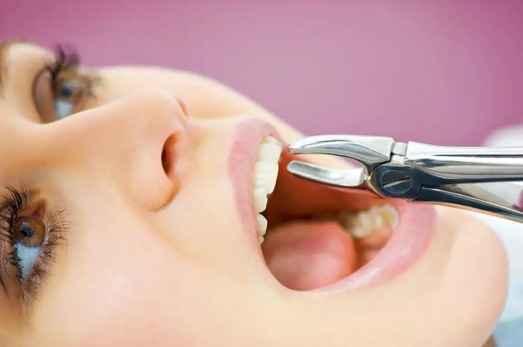 como quitar el dolor de muela dentista como quitar el dolor de muela dentista
