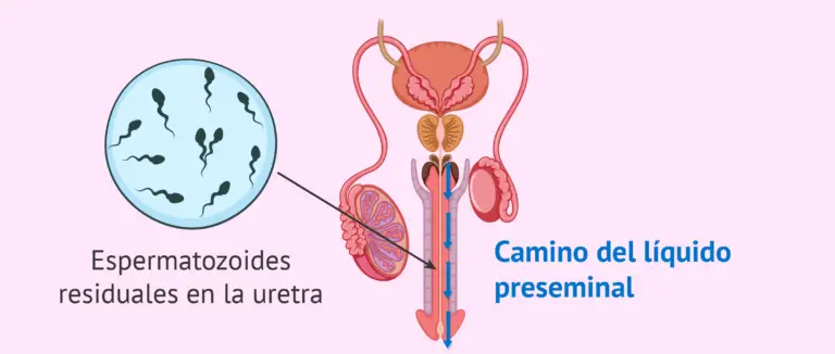 Probabilidad De Embarazo Con Liquido Preseminal