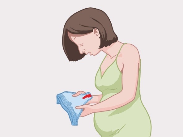 aborto espontáneo con ejercicios