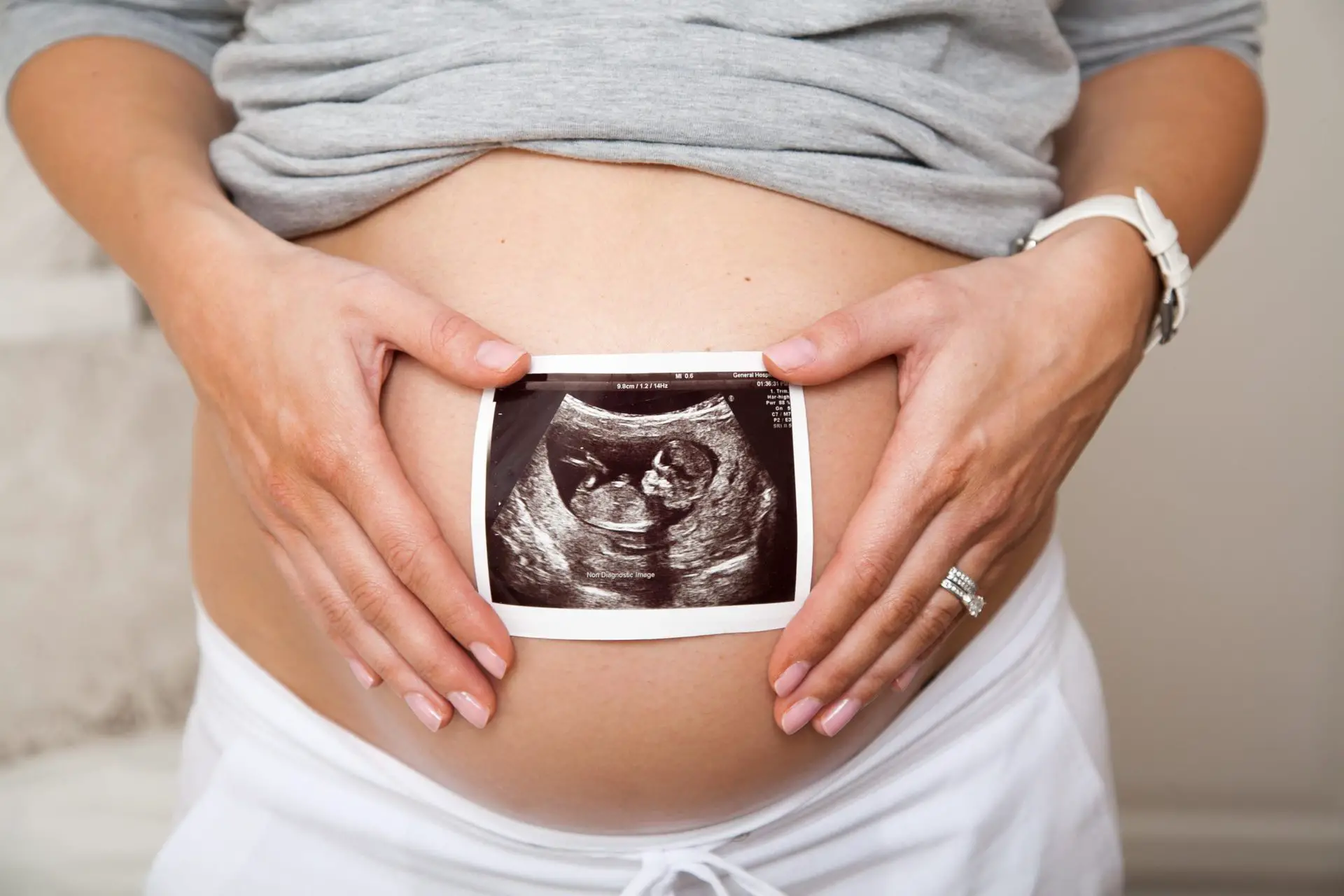 Ecografia Obstetrica en el embarazo