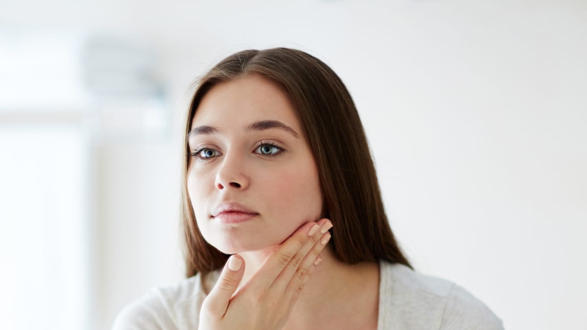 remedios caseros para el acne y las manchas