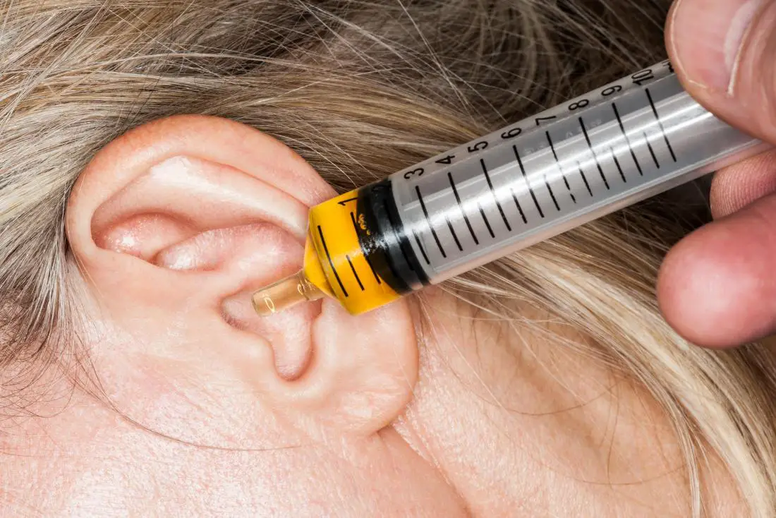 Remedios caseros para el dolor de oído