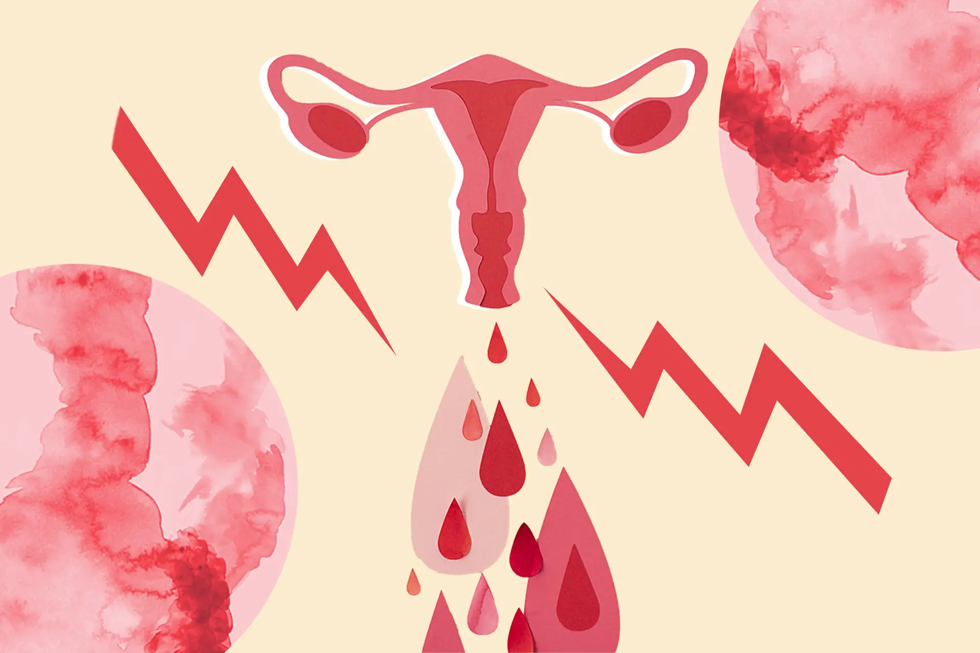 Colicos menstruales