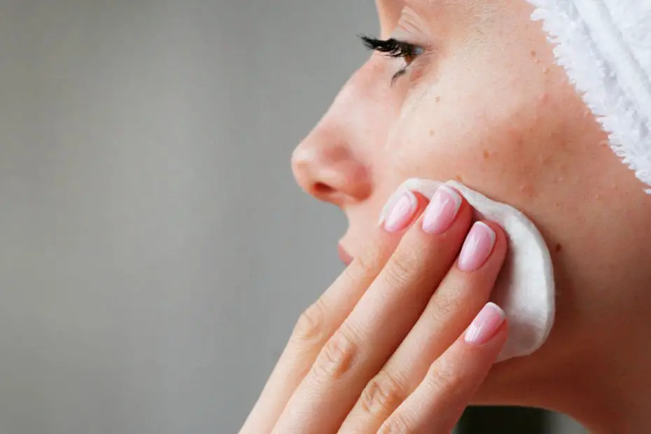 quitar manchas de acne